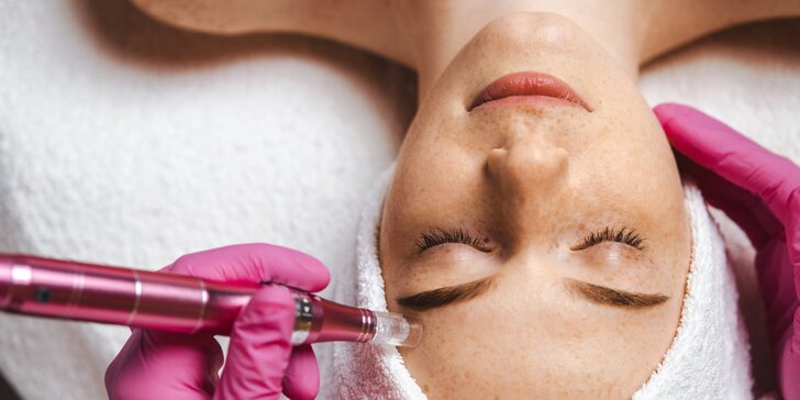 Čistenie pleti s ultrazvukom, ošetrenie s galvanickou žehličkou alebo microneedling dermapenom