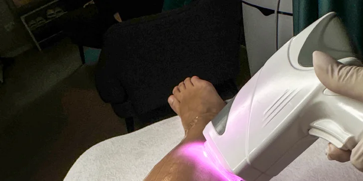 Zbavte sa chĺpkov: Laserová epilácia pre dámy aj pánov
