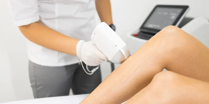 Zbavte sa chĺpkov: Laserová epilácia pre dámy aj pánov