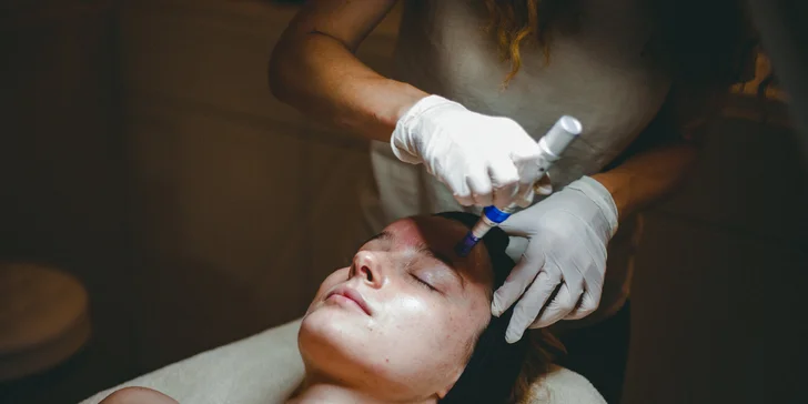 Mezoterapia pomocou dermapenu s jemným chemickým peelingom