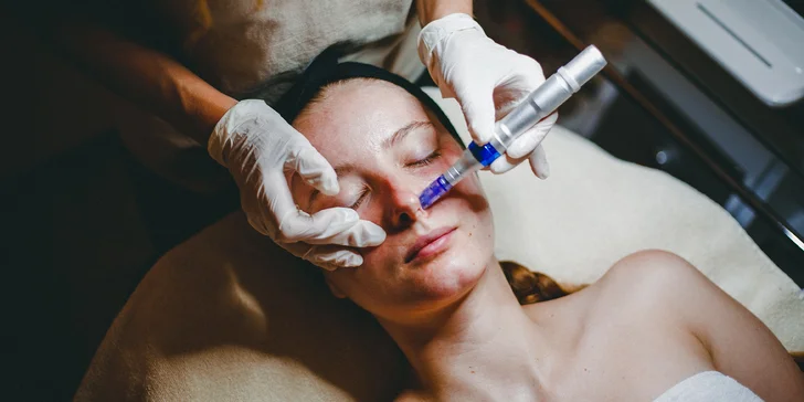 Mezoterapia pomocou dermapenu s jemným chemickým peelingom
