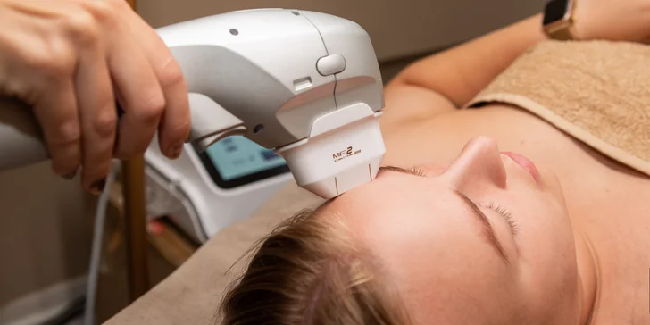 Hifu Ultherapy 7D: Neinvazívny lifting tváre, krku aj dekoltu