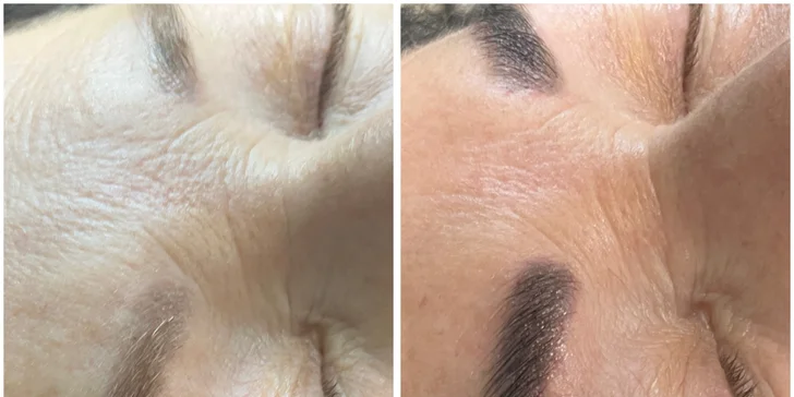 Minitetovanie, microblading, akvarelové pery či púdrové obočie s korekciou v cene v Em Artist Studio