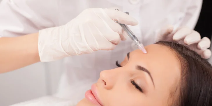 Korekcia vrások v okolí očí, v medziobočí alebo na čele pomocou botoxu