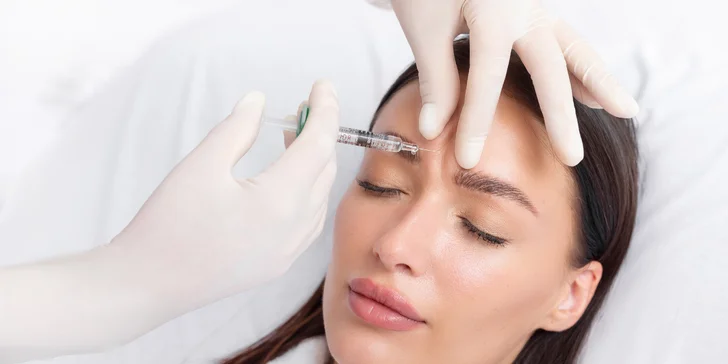 Korekcia vrások v okolí očí, v medziobočí alebo na čele pomocou botoxu