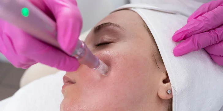 Plazma lift pen alebo mezoterapia tváre pre pevnú a pružnú pokožku