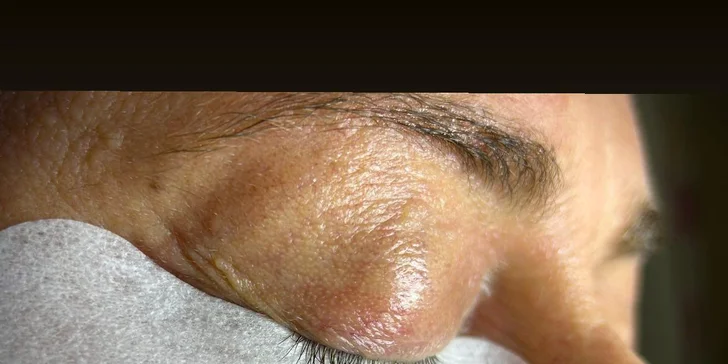 Laminácia obočia alebo Lash lift mihalníc pre výrazný pohľad