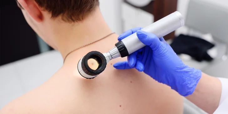 Kontrola až 5 znamienok alebo podozrivých novotvarov a odborná konzultácia u dermatologičky