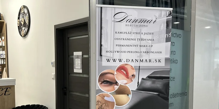 Estetická kamufĺáž strií a jaziev pigmentom alebo kyselinou hyalurónovou