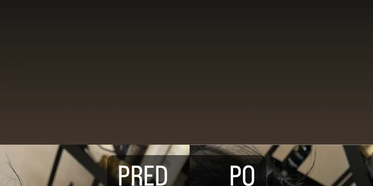 Omladzujúce ošetrenia: Chemický peeling s biopeptidmi, hĺbkové čistenie pleti, rádiofrekvencia, mezoterapia a i.