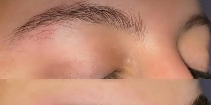 Frakčná mezoterapia, laminácia obočia, lash lifting, hydratačné ošetrenie pleti alebo masáž pleti