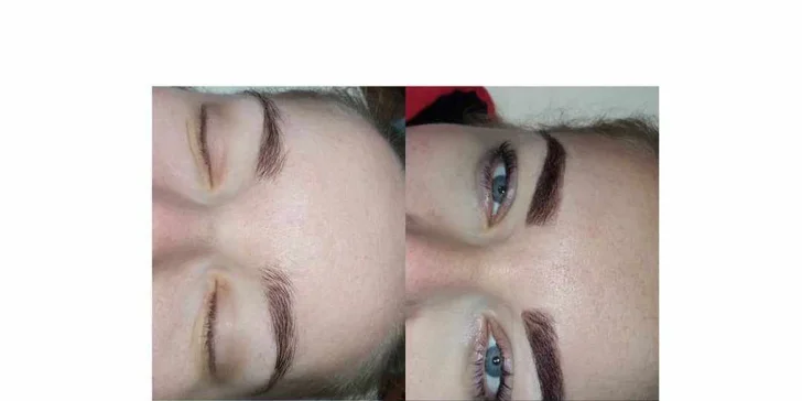 Frakčná mezoterapia, laminácia obočia, lash lifting, hydratačné ošetrenie pleti alebo masáž pleti