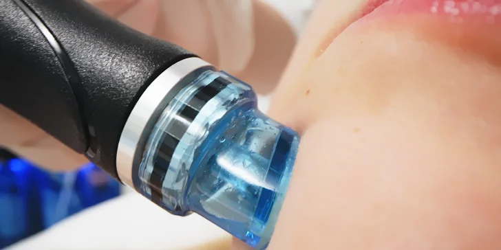 Revolučné ošetrenie Hydrafacial pre žiarivú a hydratovanú pleť