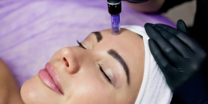 7 techník PMU alebo mezoterapia dermapenom