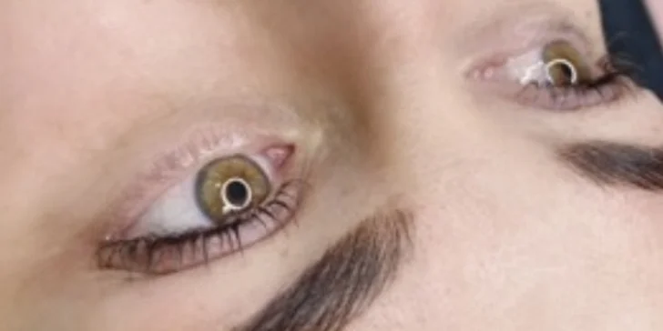 Laminácia, Lash Lift, hydratácia pier alebo mezoterapia dermapenom