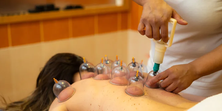 Myofasciálna, relaxačná alebo klasická masáž aj s bankovaním