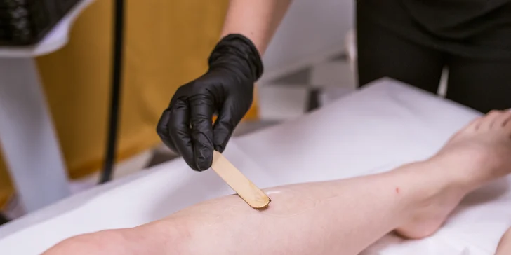 Odstránenie ochlpenia pomocou vysoko výkonného diódového lasera