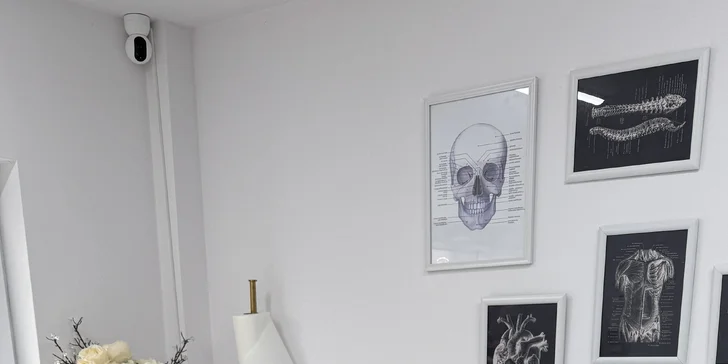 Medicínska epilácia chĺpkov diódovým laserom - nohy, bikiny, pazuchy a i.