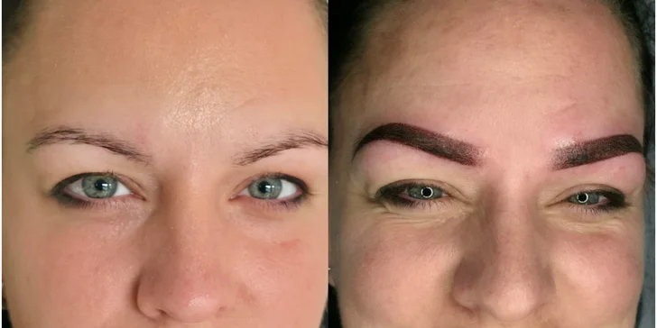 7 techník PMU alebo mezoterapia dermapenom či úprava obočia