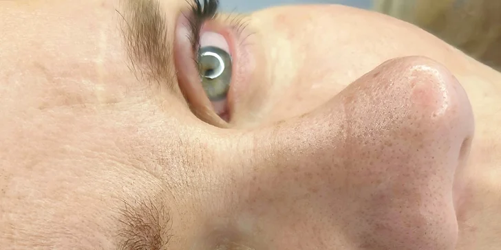 7 techník PMU alebo mezoterapia dermapenom či úprava obočia