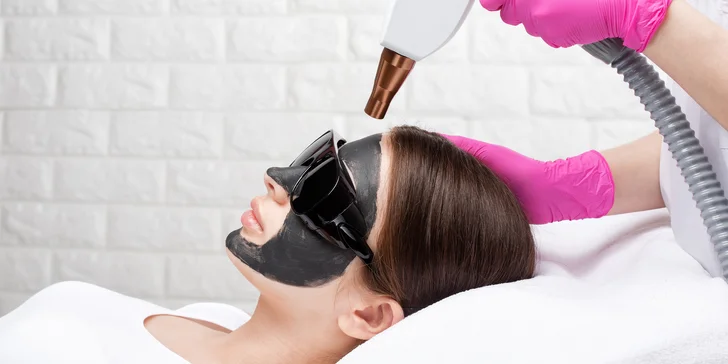 Karbónový Hollywood peeling alebo omladenie kyselinou hyalurónovou