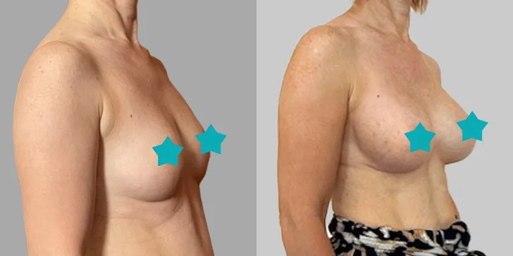 Špičková Aurel Clinic: Zľava na facelift, zubné korunky či prsné implantáty