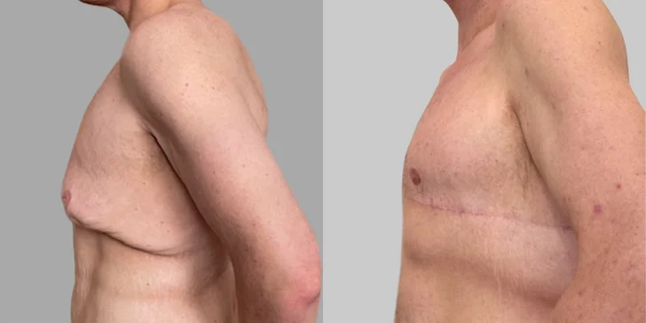 Špičková Aurel Clinic: Zľava na facelift, zubné korunky či prsné implantáty
