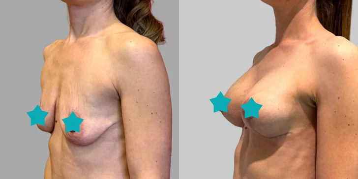Špičková Aurel Clinic: Zľava na facelift, zubné korunky či prsné implantáty