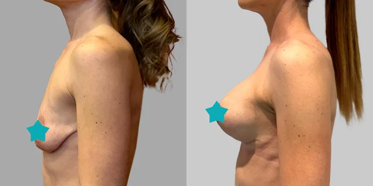Špičková Aurel Clinic: Zľava na facelift, zubné korunky či prsné implantáty