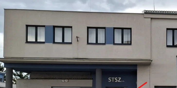 Laserová epilácia pre pánov: Zbavte sa chĺpkov v podpazuší či na bruchu