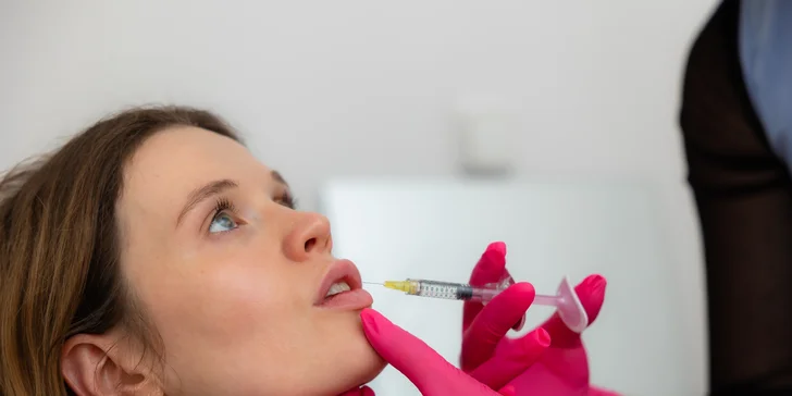 Upravenie, výplň, hydratácia alebo modelácia pier kyselinou hyalurónovou