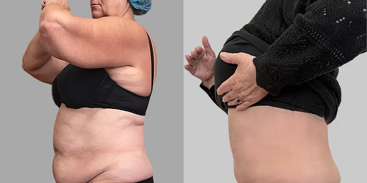 Špičková Aurel Clinic: Zľava na facelift, zubné korunky či prsné implantáty