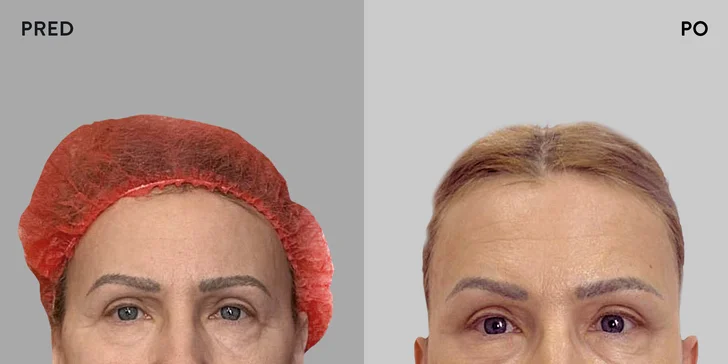 Špičková Aurel Clinic: Zľava na facelift, zubné korunky či prsné implantáty