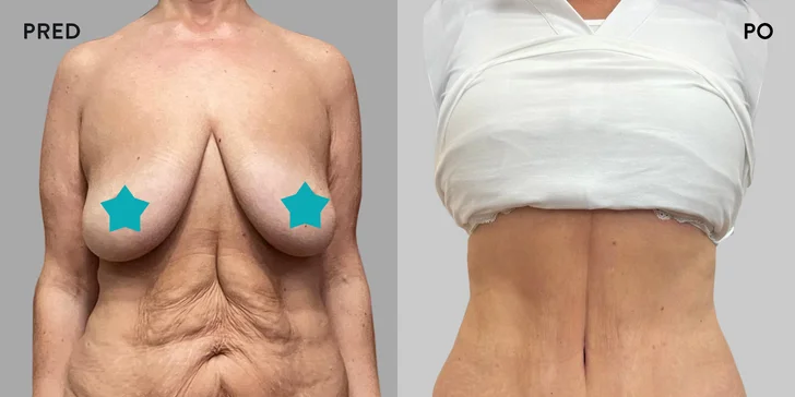 Špičková Aurel Clinic: Zľava na facelift, zubné korunky či prsné implantáty