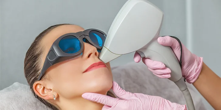 Laserová epilácia pre dámy: Horná pera, brada, podpazušie, predkolenie, stehná či bikiny