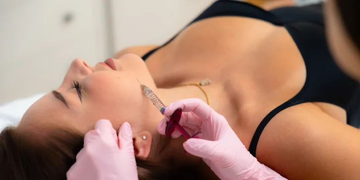 Skinbooster: Aplikácia kyseliny hyalurónovej pre hĺbkovú hydratáciu pleti