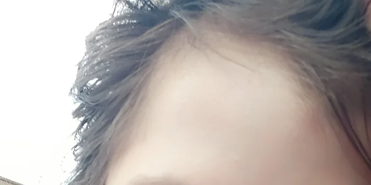 Pomoc pre Katku s DMO a ďalšími závažnými diagnózami