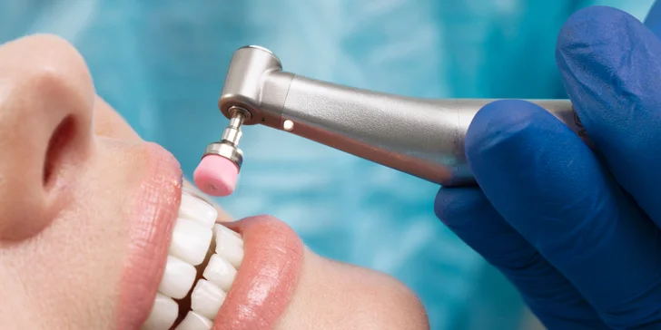 Zdravý úsmev na celý rok: 2× dentálna hygiena za zvýhodnenú cenu
