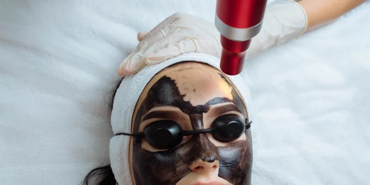 Hollywood peel: Karbónový peeling pre krásny, rozžiarený a jednotný tón pleti