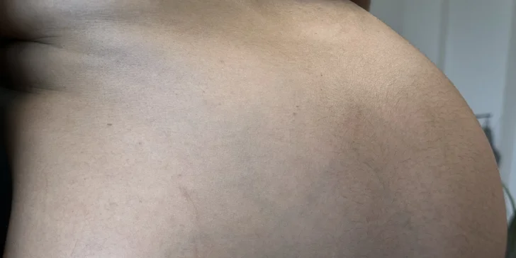Cukrový nástrek: Bezpečné opálenie bez slnka a solária