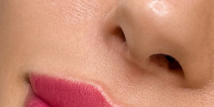Výplň pier kyselinou hyalurónovou alebo hĺbkovo hydratačný "Lip Booster"