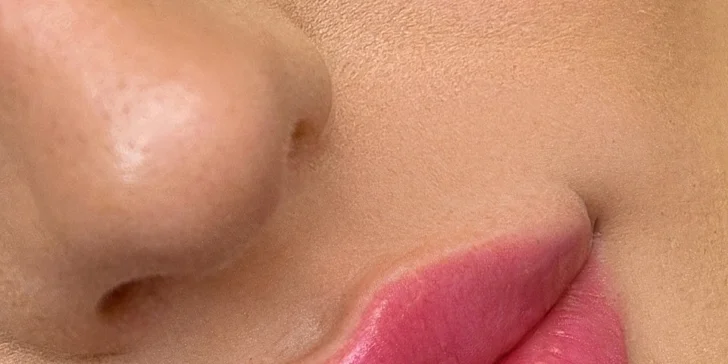 Výplň pier kyselinou hyalurónovou alebo hĺbkovo hydratačný "Lip Booster"