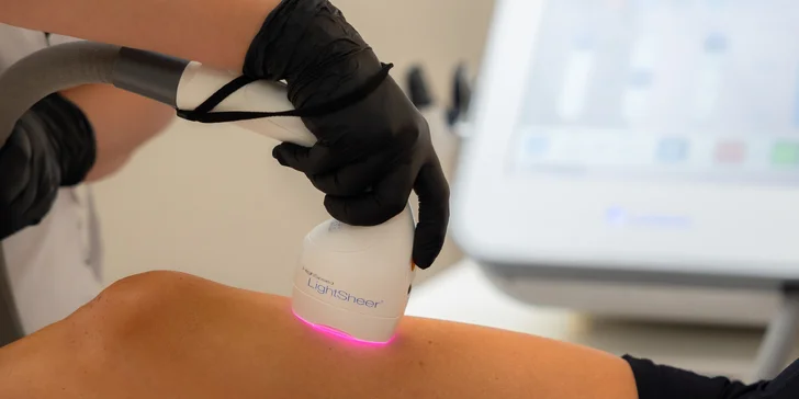 Zbavte sa chĺpkov raz a navždy s laserovou epiláciou aj v rámci výhodného balíčka