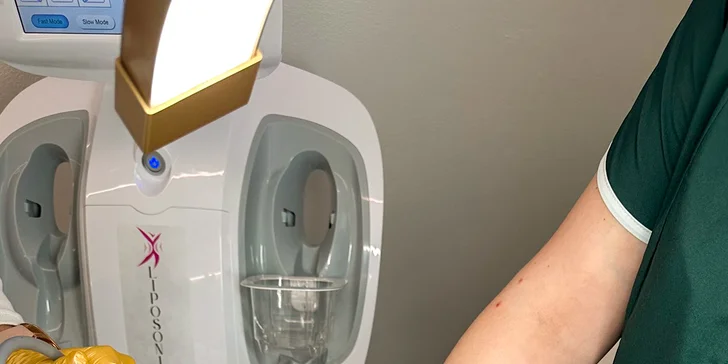 Neinvazívna liposukcia ultrazvukom Liposonix AVA .I.