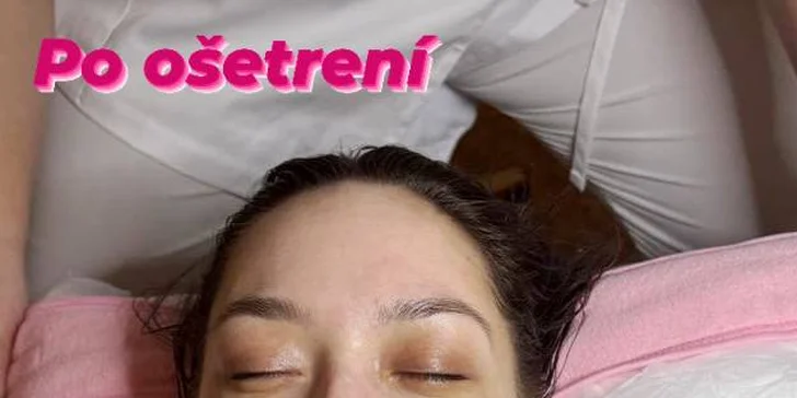 Kozmetické ošetrenia pre čistú a mladistvú pleť bez vrások