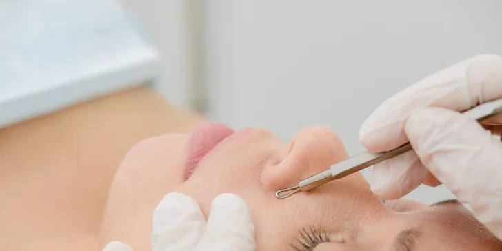 Hĺbkové čistenie, vodná dermabrázia, lifting pleti pomocou rádiofrekvencie alebo rádiomezolift XILIA GLOW