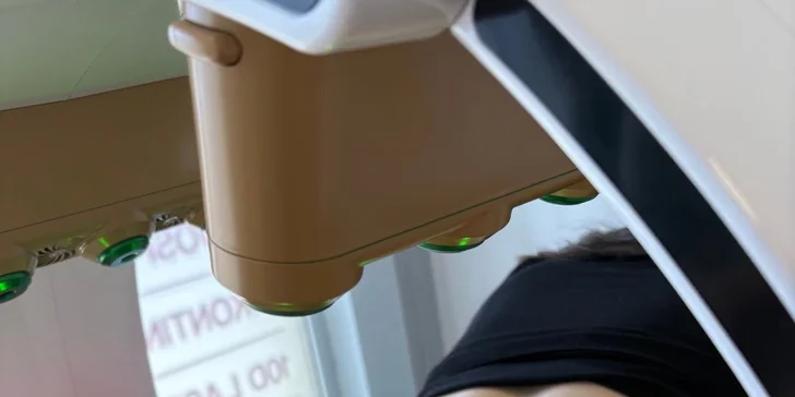 Zoštíhľovacie a tvarujúce procedúry v BeYou studio