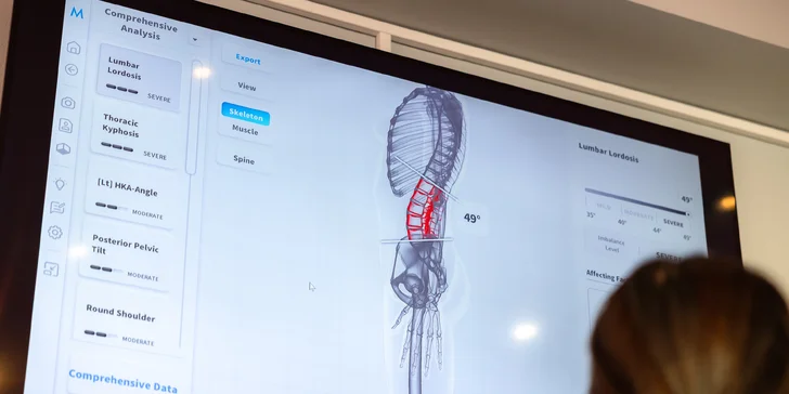 Zistite, v akom stave je vaše telo: Fyziodiagnostika aj individuálny tréning na mieru