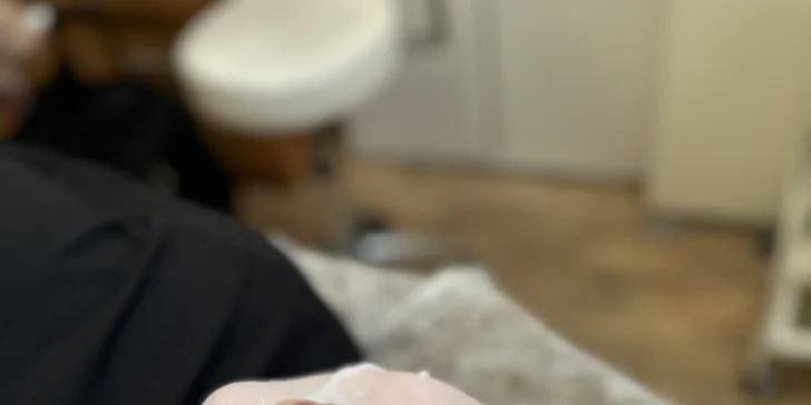 Čistenie pleti, mikrodermabrázia alebo ultrazvukové čistenie s microneedlingom
