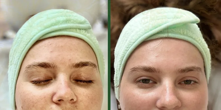 Darčeková poukážka na všetky služby salónu SARAKA SKIN THERAPY v hodnote 50 alebo 70 €